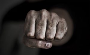 Гродненец сделал ремонт в тренажерном зале и утверждает, что за это ему сломали нос 