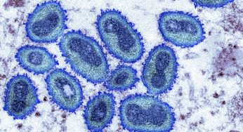 Гродно готовится бороться с оспой обезьян. Что это за болезнь и чем она опасна (8 карточек)