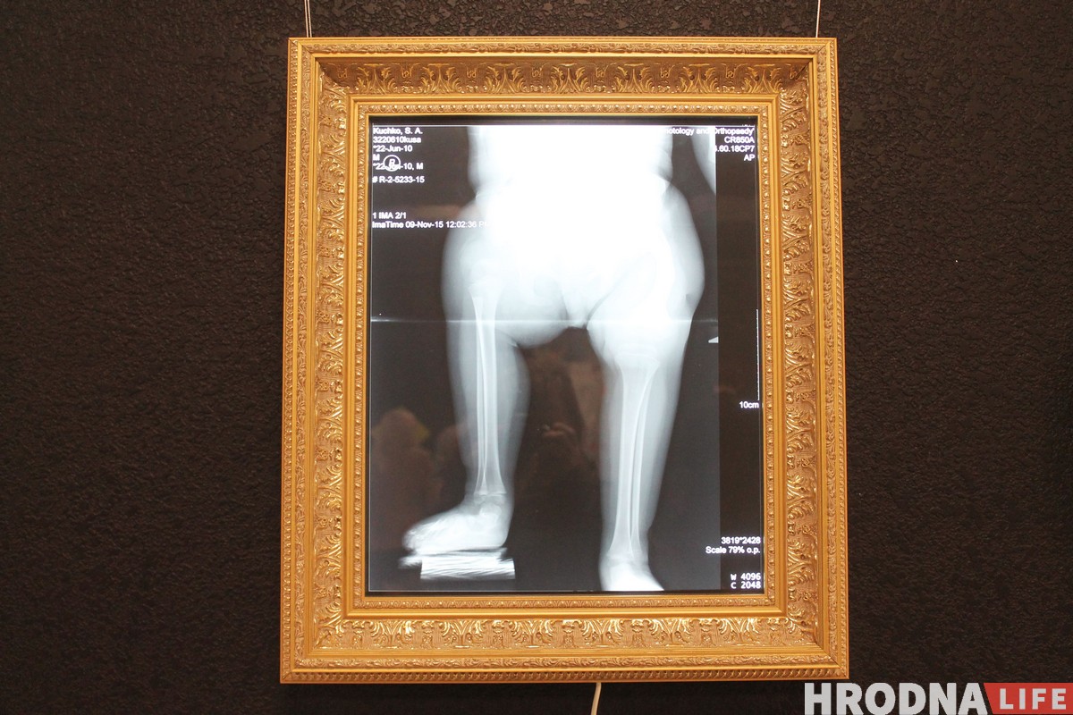 “Лес дзяўчыны”. У Гродне адкрылася выстава з творамі, якія можна знішчаць “Лес дзяўчыны”. У Гродне адкрылася выстава з творамі, якія можна знішчаць