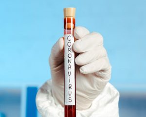 У Гродне адкрыюць другую ў вобласці лабараторыю па тэставанні на каранавірус. На Гродзеншчыне - новыя ачагі У Гродне адкрыюць другую ў вобласці лабараторыю па тэставанні на каранавірус. На Гродзеншчыне - новыя ачагі