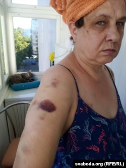 «Заткн еб🤬ло, с🤬ка». 55-летняя гродненка при задержании укусила омоновку. Её избили, а сейчас завели уголовное дело